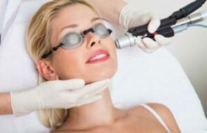 Laserová procedúra omladenia pokožky tváre