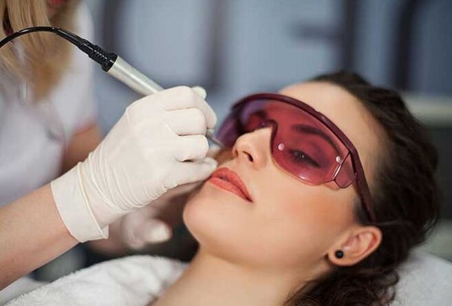 Laserová biorevitalizácia