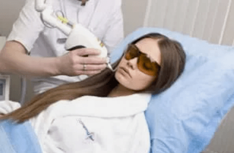 frakčná laserová rejuvenizácia